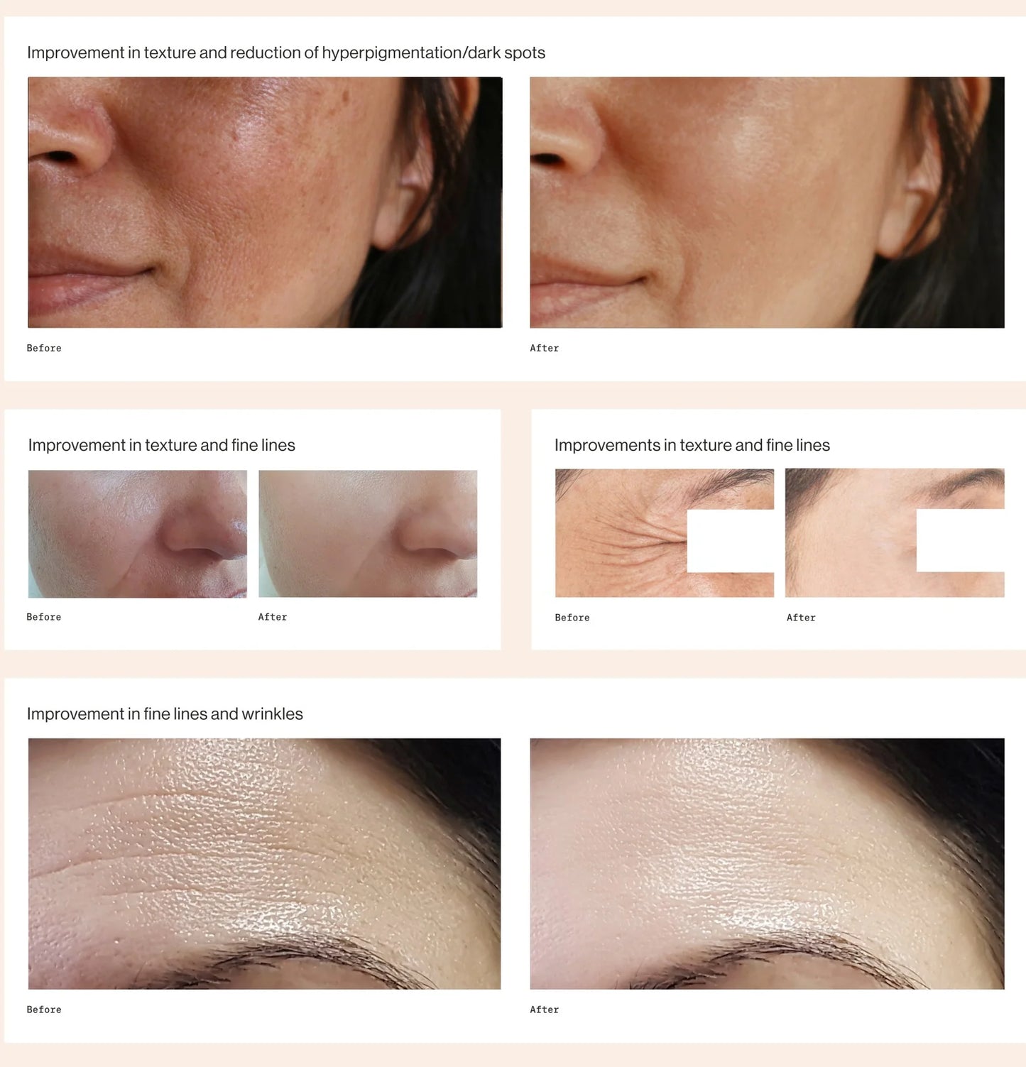 Blue Biotic™ Multi-Effect Bioactive Peptide Cream (Botox in a jar)